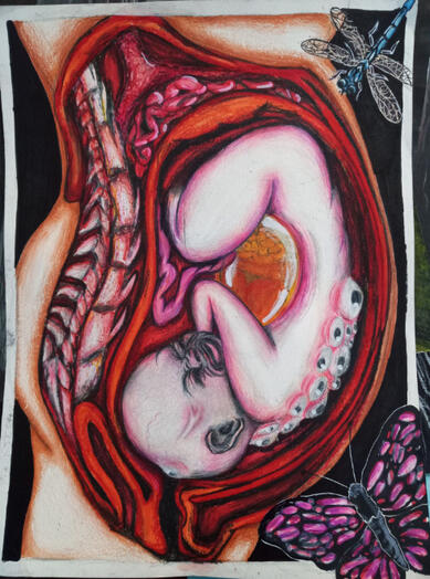 Untitled Untitled